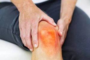 Fakta Medis Seputar Asam Urat Memahami Kondisi Penyebab Dan Pengelolaannya